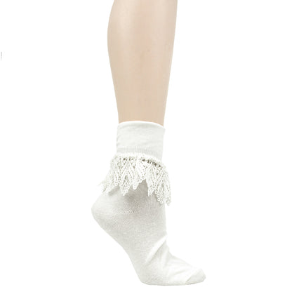 Lace Anklet